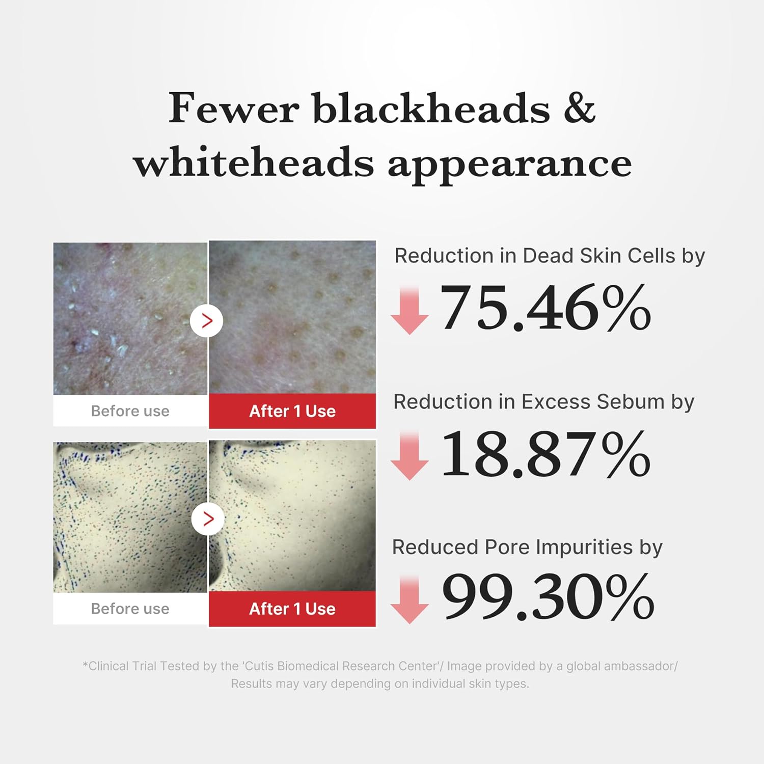 Medicop Hypochlorous Acid Peeling Solution – 80ml