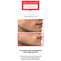 SOME BY MI Black Snail Renewal Set - 4pcs