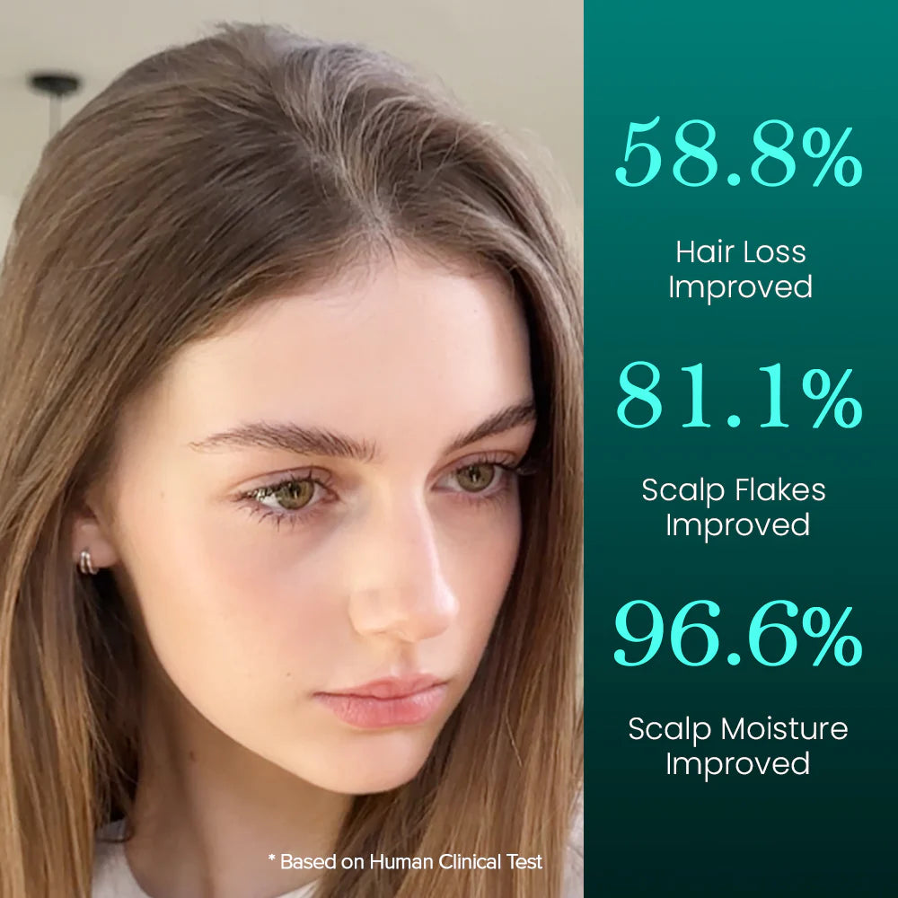 My Beauty Five Lab Scalp Boosting Foam – 100ml