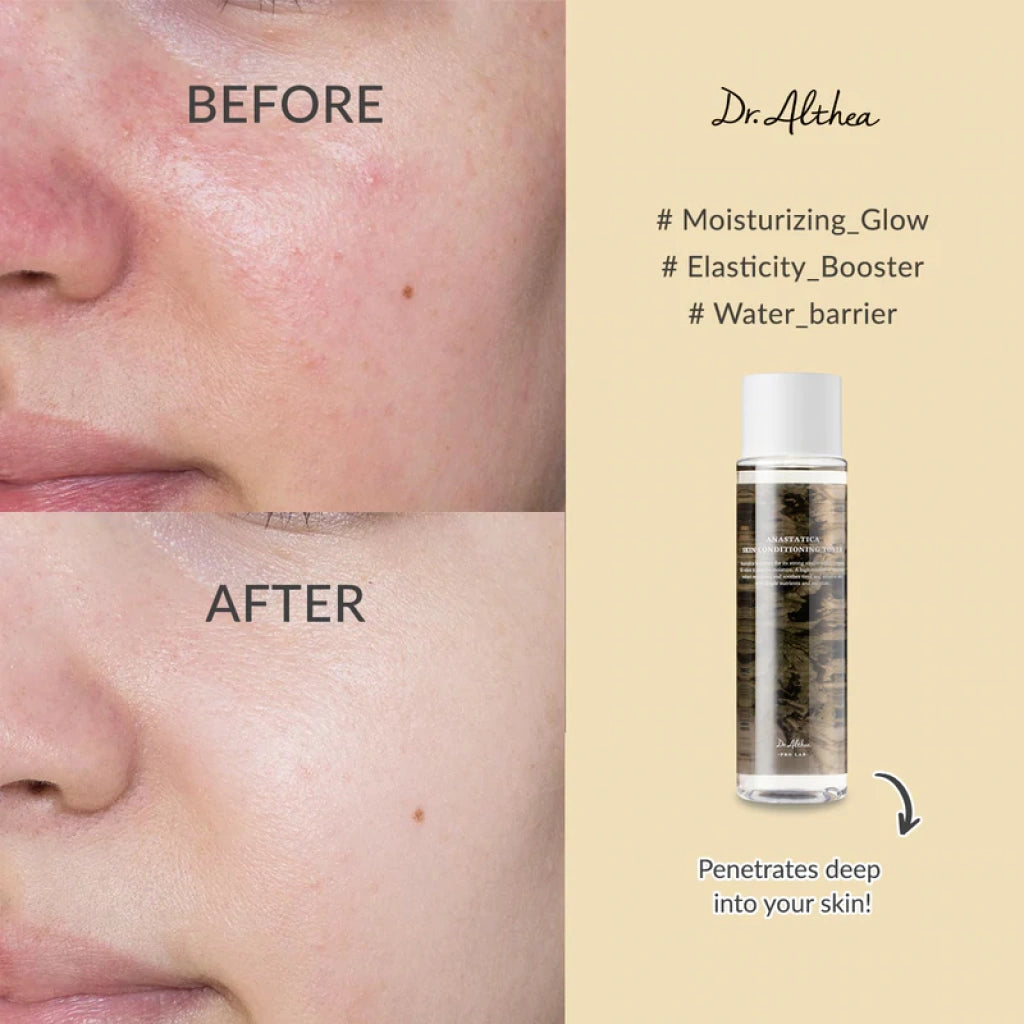 تونر أنستاتيكا لتهدئة وترطيب البشرة من د. الثيا – 250مل