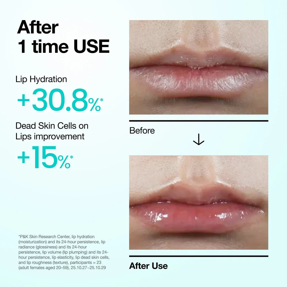 Anua PDRN Lip Serum - 10ml – بيوتي تايم