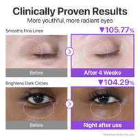 numbuzin No. 9 NAD+ Bio Lifting Eye Cream – 10 ml