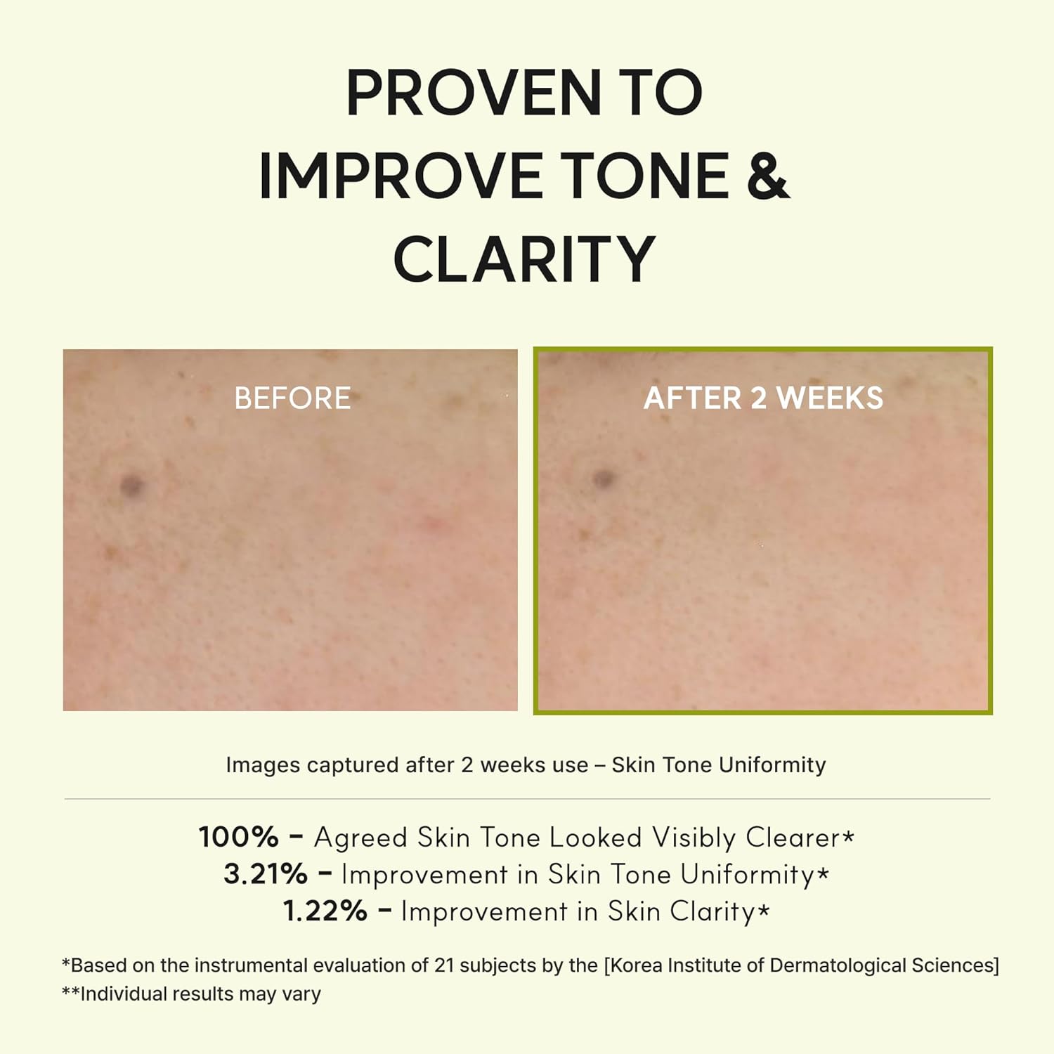 glutathione acne before a L-Glutathione Glow On Brightening Toner Arencia Vitamin C & Glutathione